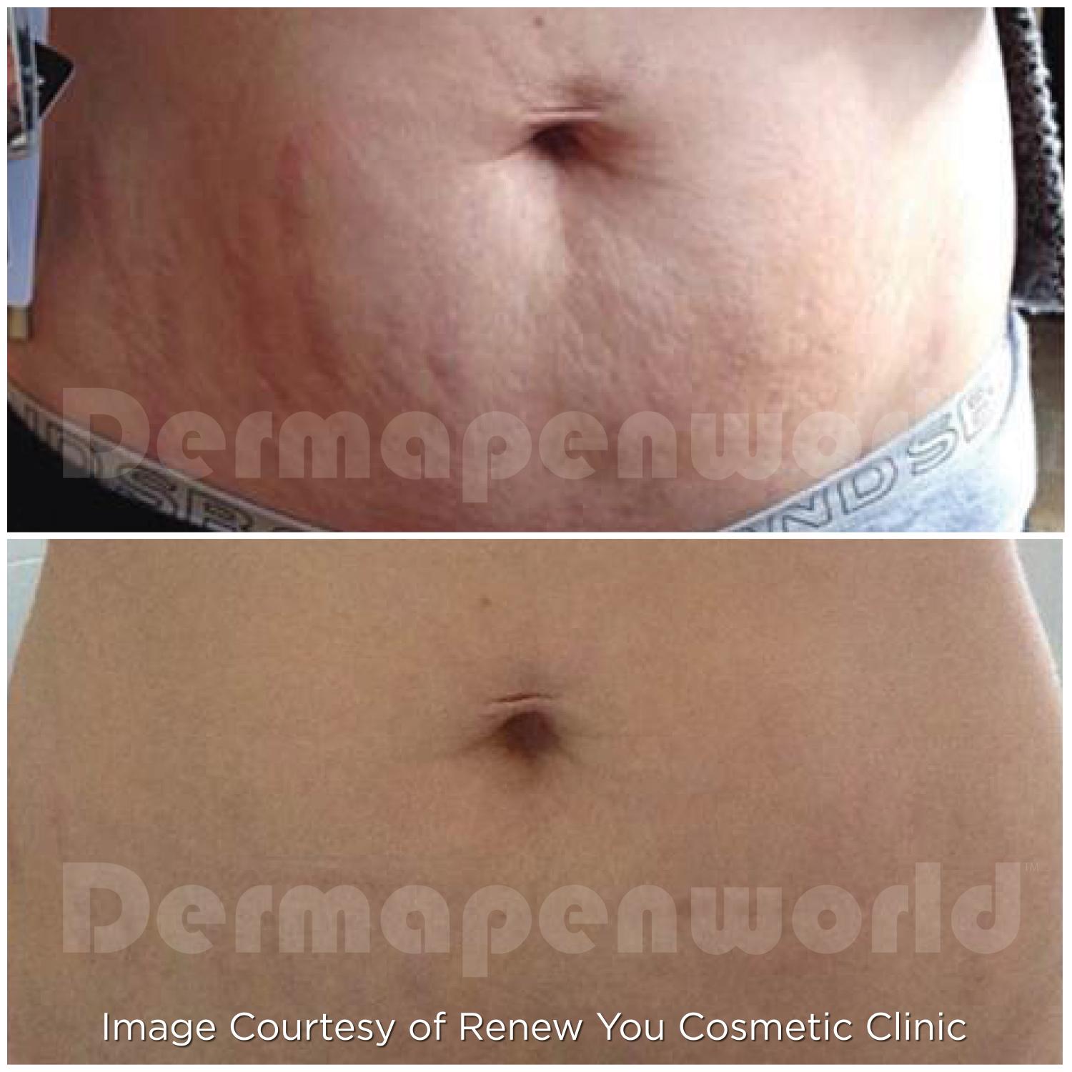 ba5e9e5a-443f-40a6-9abf-fd83e9a50a53