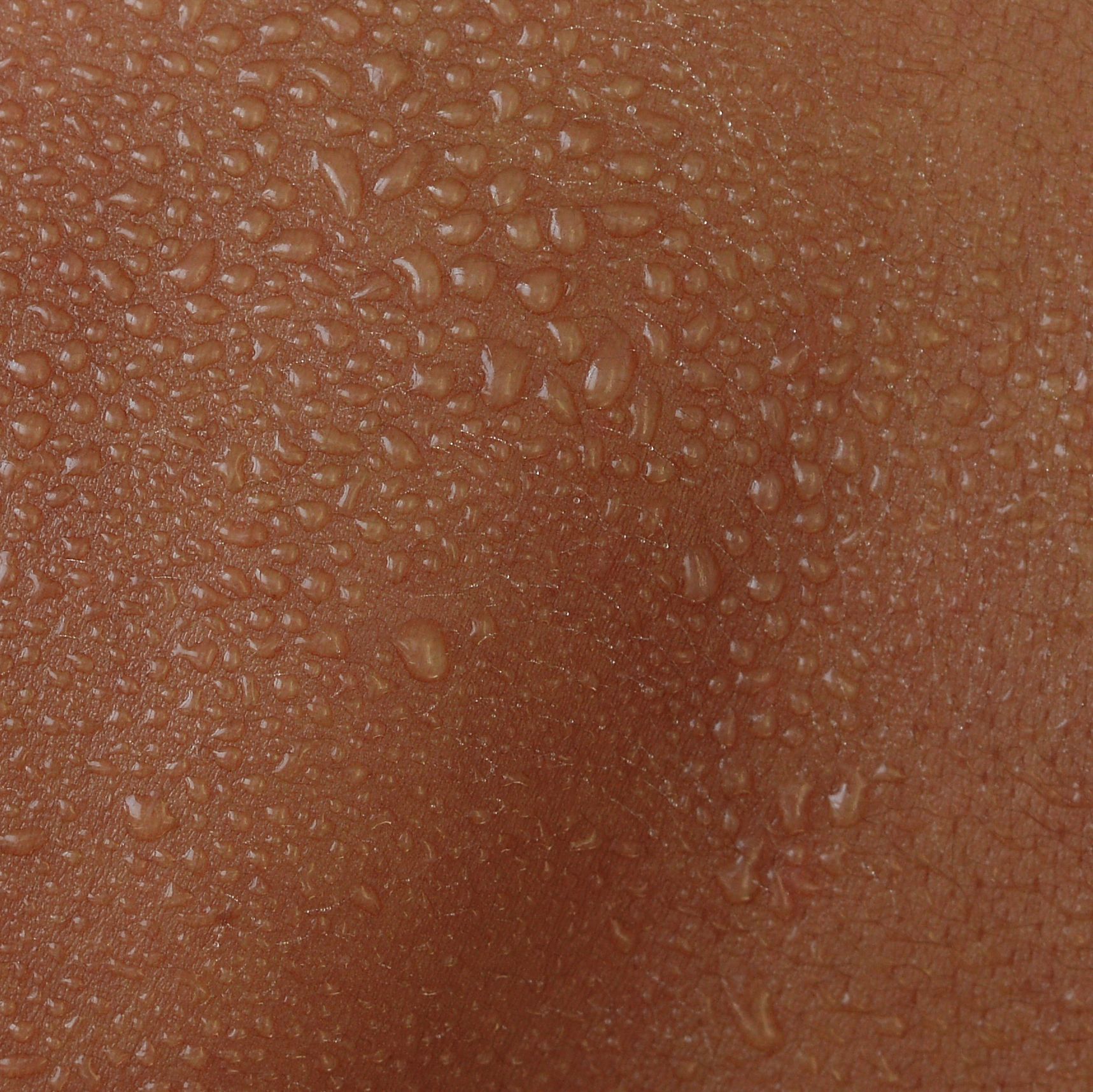 Under-eye hollows and dark circles