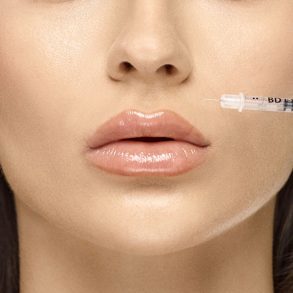 Under-eye hollows and dark circles