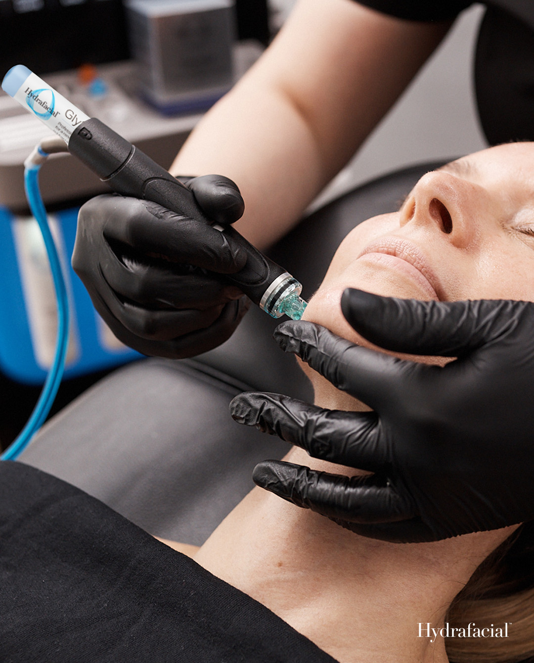 Signature HydraFacial at Phantom Aesthetics